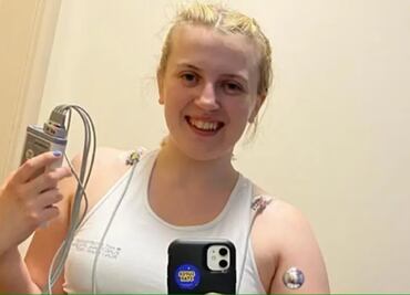 "Reír o estar triste puede matarme": La historia de Natasha Coates, la mujer que no puede tener emociones