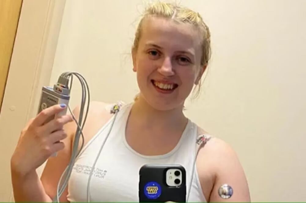 Natasha Coates tuvo reacciones extrañas desde pequeña (Foto: Instagram @natashacoatesgb)