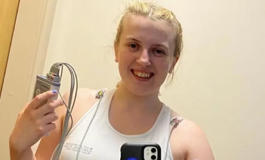 Natasha Coates tuvo reacciones extrañas desde pequeña (Foto: Instagram @natashacoatesgb)