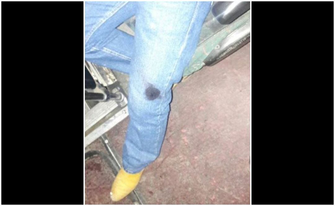 Foto: @alertasurbanas