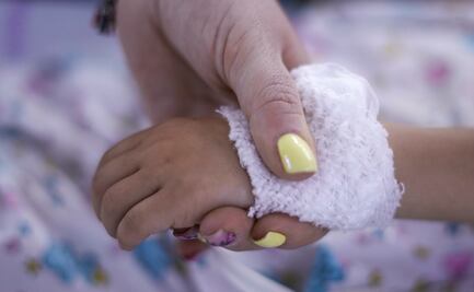 Detectan primer caso de Hepatitis Infantil Grave de origen desconocido en Yucatán 