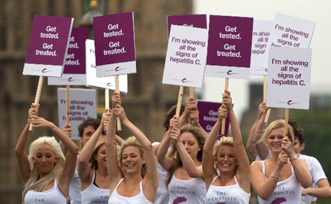 Entre 130 y 150 millones de personas viven con hepatitis C en todo el mundo. Foto: Archivo