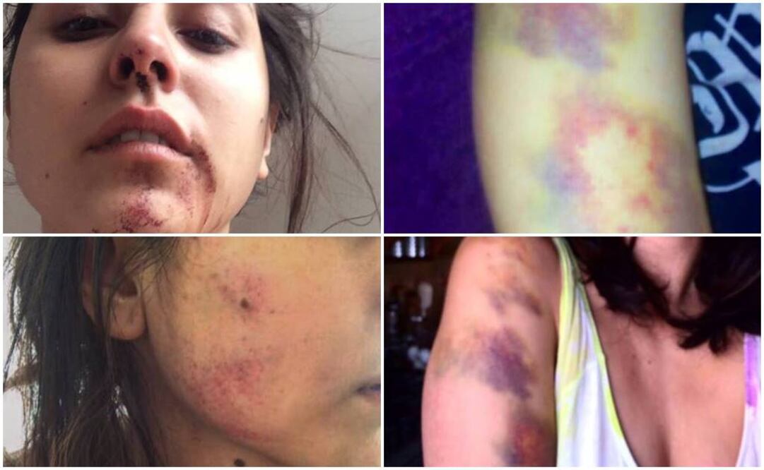 Fotos: Tomada de Facebook Ximena Gama