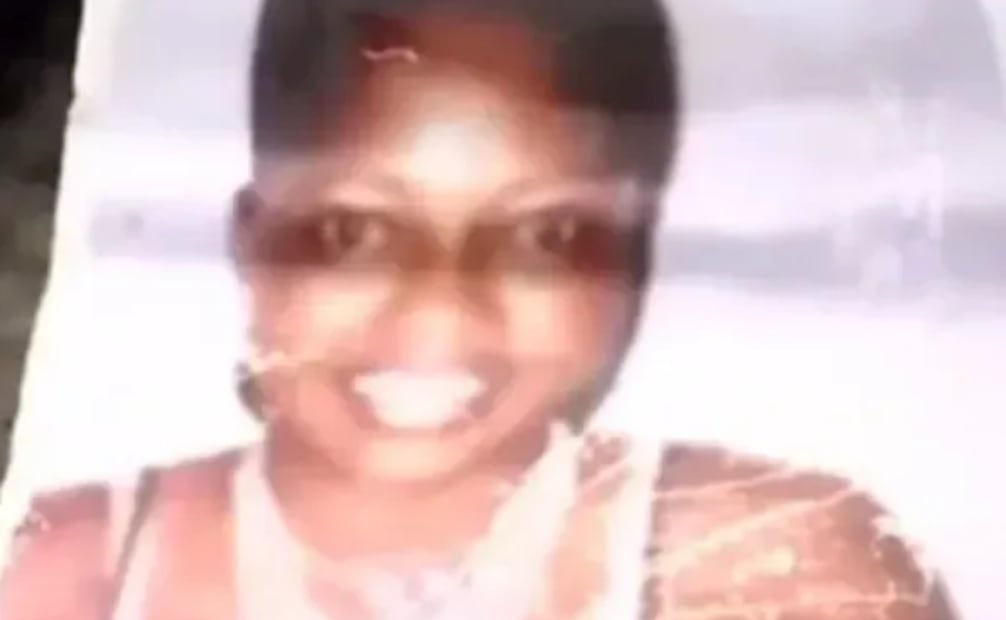 María Consuelo Córdoba relata que se quedó sin rostro. (03/09/26) Foto: El Tiempo
