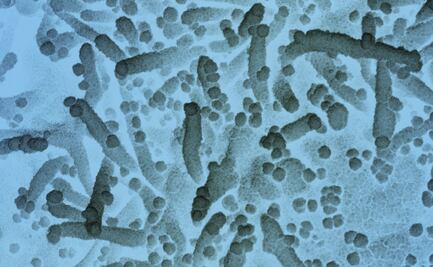 Covid-19 sería menos virulento que un resfriado en unos años: expertos