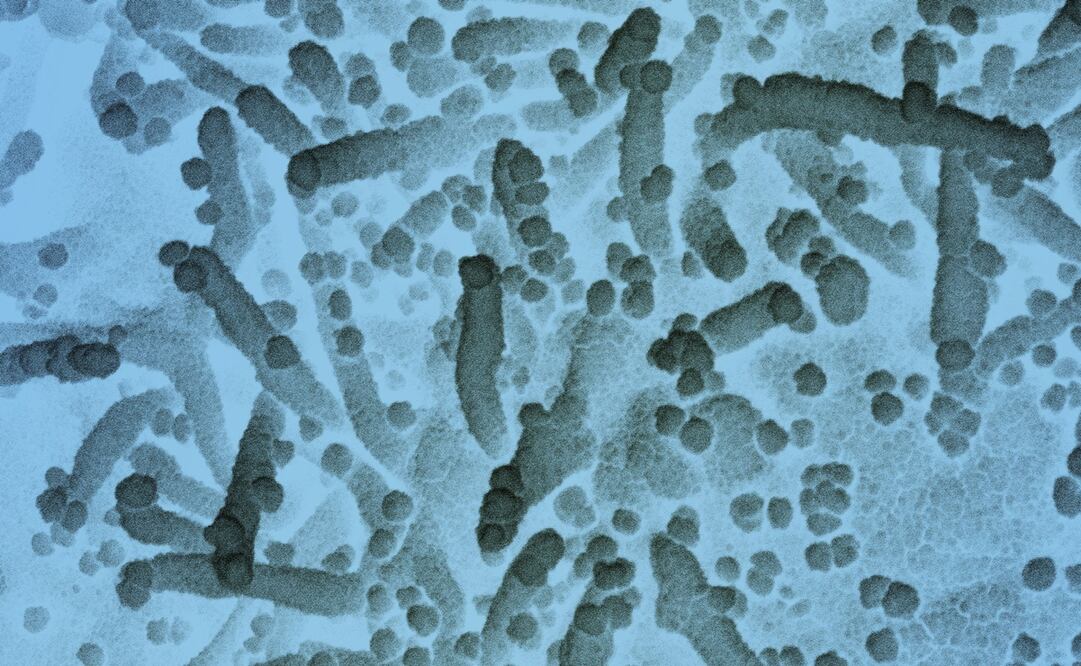 Foto: EFE/EPA/NIAID/NATIONAL INSTITUTES OF HEALTH