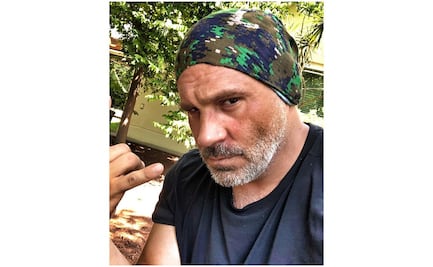 Arath de la Torre tiene más cirugías que Jaitovich