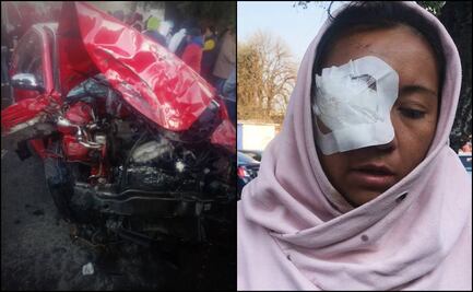 Cinthya está a punto de perder la visión de un ojo, pide justicia por "microbusazo" de Naucalpan