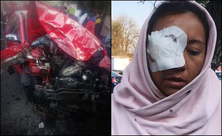 Cinthya está a punto de perder la visión de un ojo, pide justicia por "microbusazo" de Naucalpan