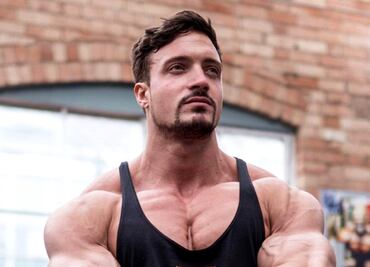 ¿Qué es un aneurisma, padecimiento por el que murió el influencer Jo Lindner?