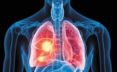 Los pulmones también albergan anticuerpos contra el Covid-19
