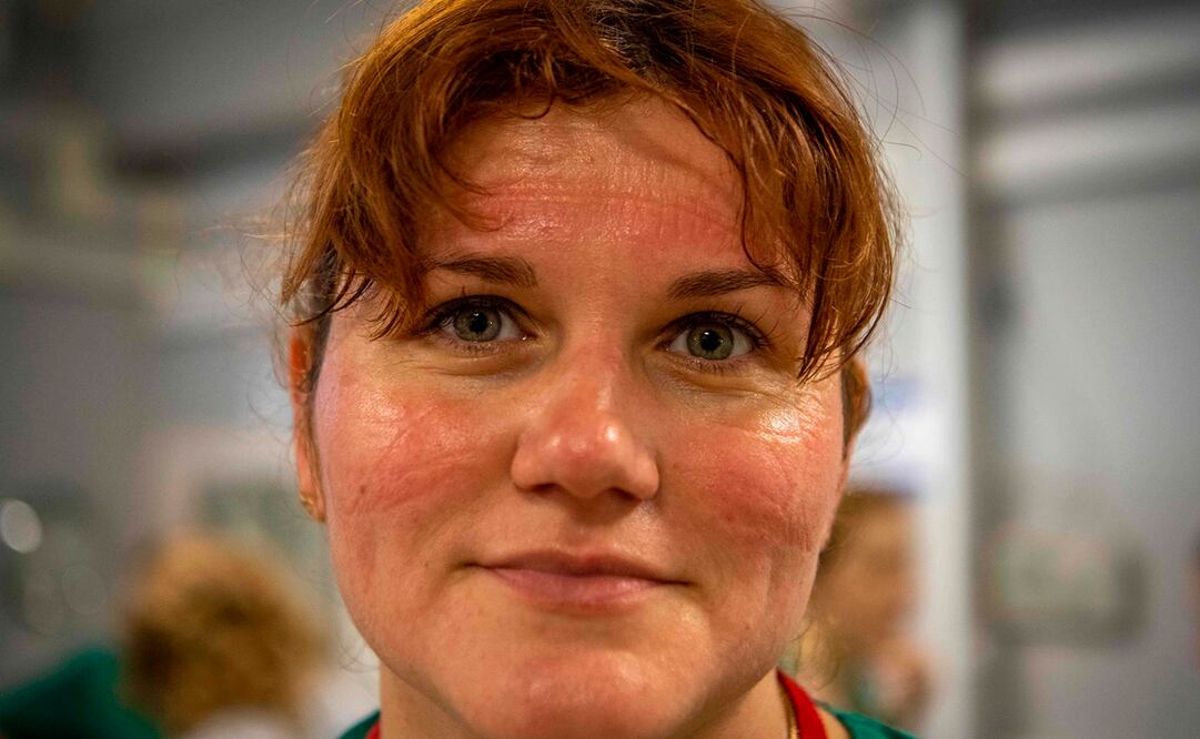 Una enfermera de Rusia muestra sus marcas por el equipo de protección (Foto: AFP)