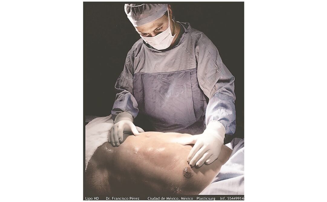 A pesar de que México ocupa el quinto lugar mundial con el mayor número de procedimientos, los mexicanos no están dispuestos a aceptar que se sometieron a uno. Fotos: FRANCISCO PÉREZ