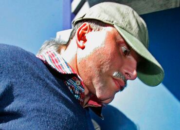 "Chupeta", el capo colombiano que modificó su mandíbula, los ojos, la nariz, los pómulos, las orejas...