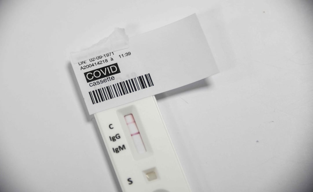 A positive COVID-19 serological test is pictured at a laboratory - Photo: Sebastien Bozon/AFP