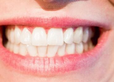 Los dientes cuentan la historia de la humanidad