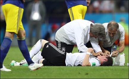 Sebastian Rudy, operado de la nariz