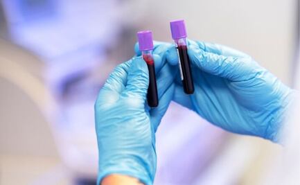 El alimento poco agradable que nadie consume pero es vital para el buen funcionamiento de la sangre