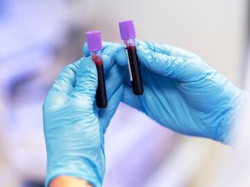 El alimento poco agradable que nadie consume pero es vital para el buen funcionamiento de la sangre