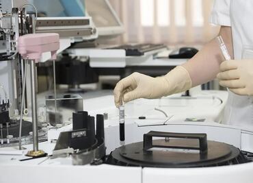 Registran brote de hepatitis vírica tipo C en Yucatán