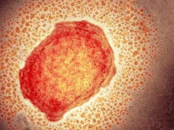 Viruela del mono. Expertos explican por qué no será una pandemia como la del Covid-19