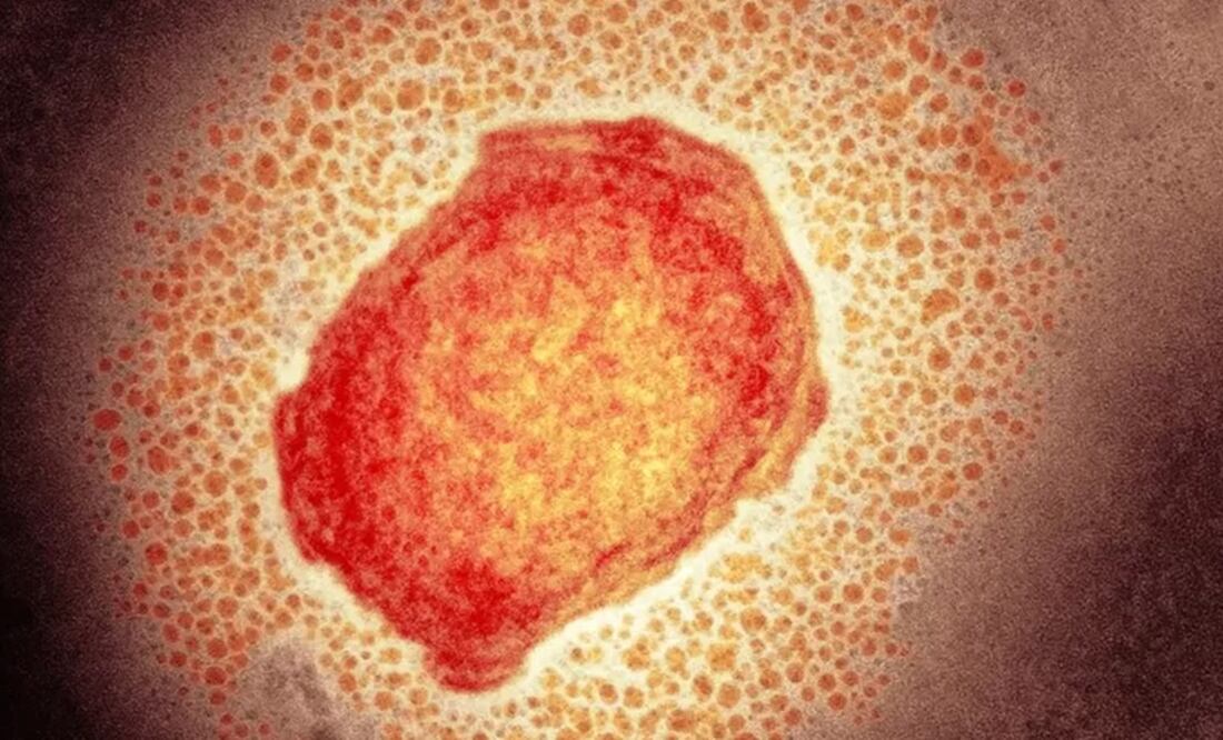 Partículas del virus de la viruela del mono. Foto: Science Photo Library