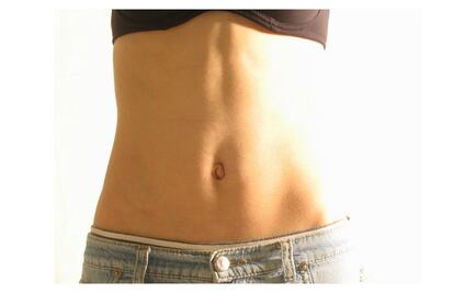 Remedios caseros para disminuir las estrías