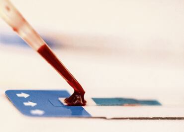 Thousands feared at risk after Mexico reforms HIV+ regime