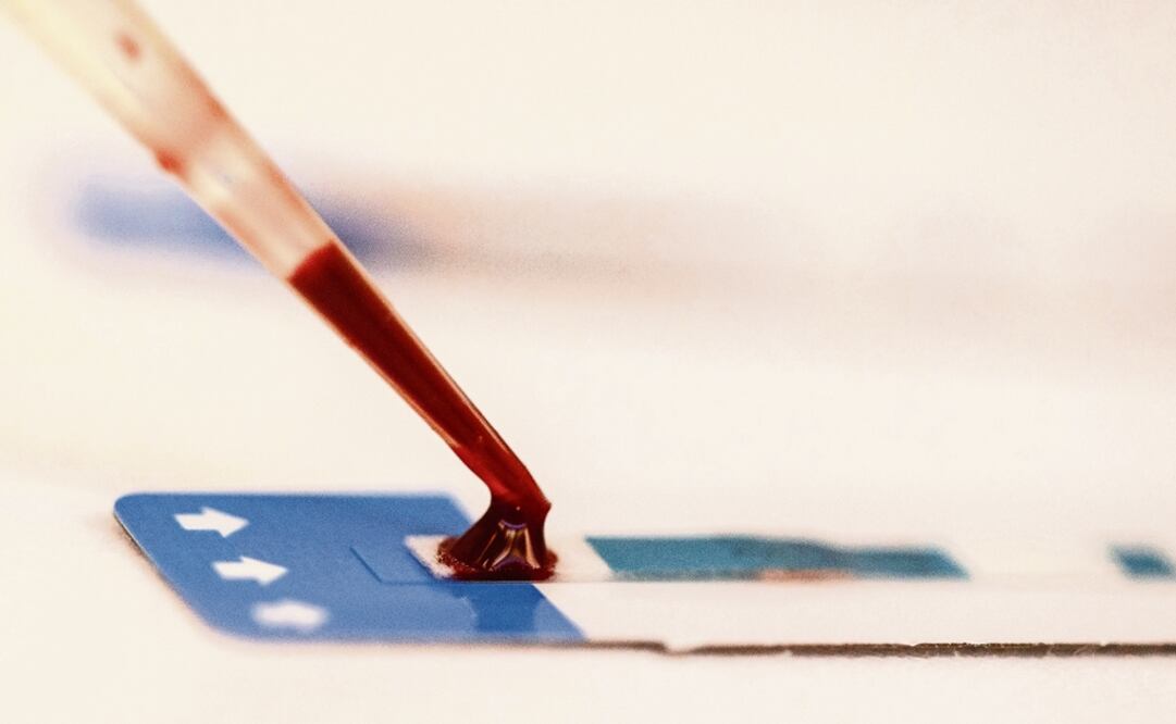 Meanwhile, according to the United Nations, of the 220,000 people in Mexico living with the disease in 2016, only 60 percent were on antiretroviral medication - Photo: Athit Perawongmetha/Reuters