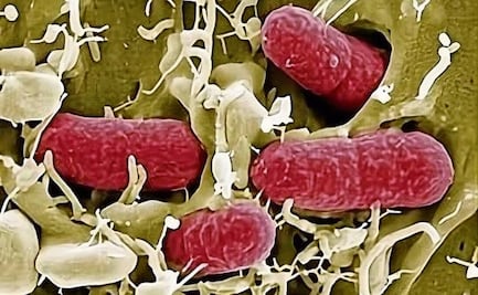 Brote de E. coli deja nueve enfermos en California; relacionan intoxicación con leche bronca y queso cheddar