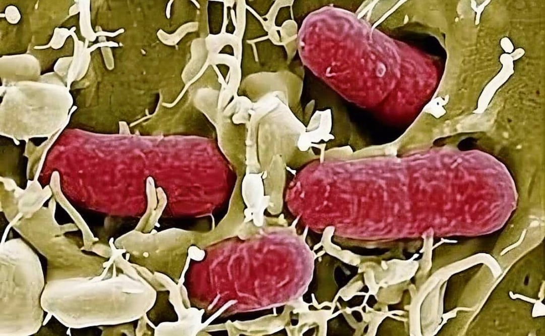 La bacteria E. coli vive normalmente en el intestino de los humanos y los animales. Foto: Especial
