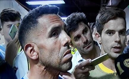 Nos están obligando a jugar el partido: Carlos Tévez