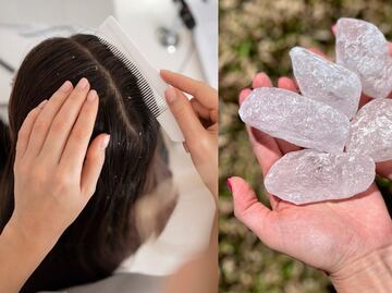 Cómo quitar la caspa del cabello con la piedra de alumbre