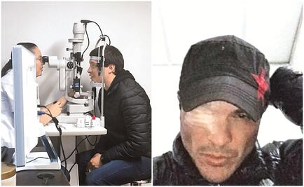 Kuno Becker se queda sin vista  