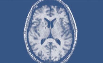 Descubre 6 movimientos que tu cerebro hace "sin permiso"