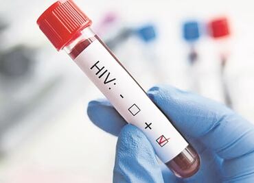 Día mundial de la lucha contra el SIDA: Lo que debes saber del VIH