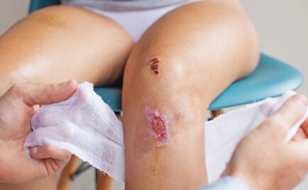 Hoy es el Día Mundial de la Hemofilia