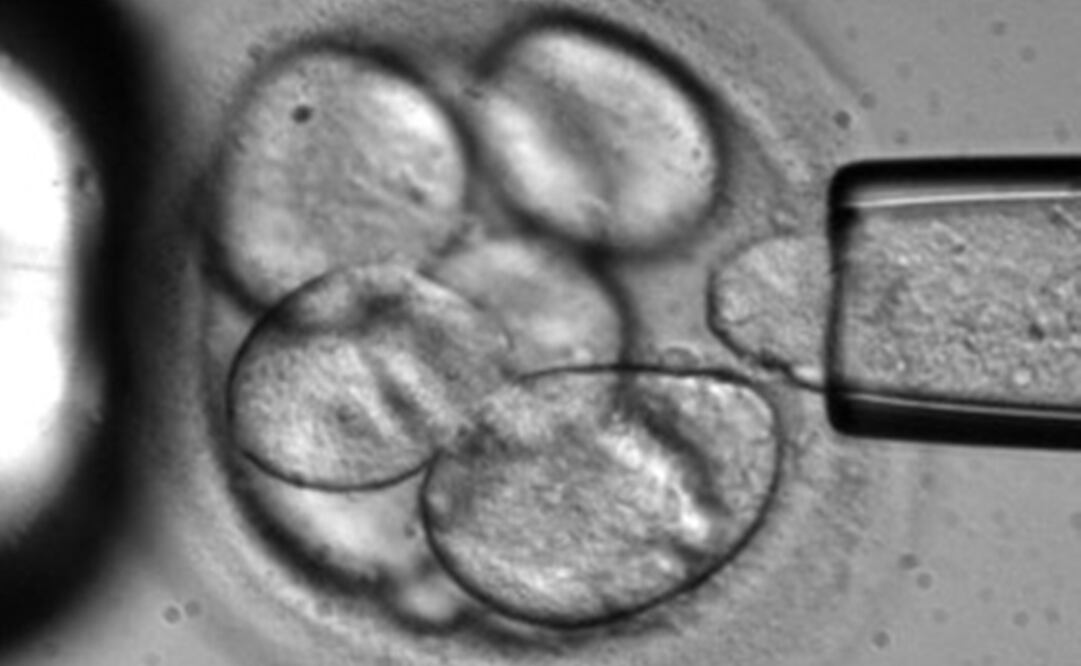 Imagen de una célula que es removida de un embrión humano. Foto: Archivo