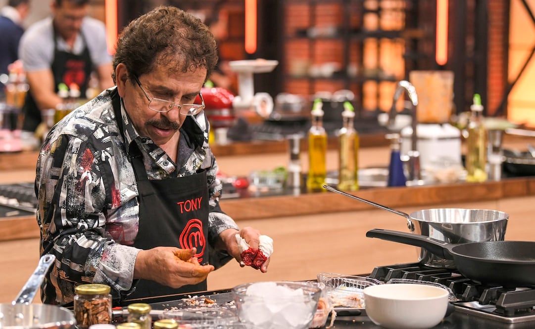 Ni la sangre ha restado motivación a Tony Balardi para ganar el concurso. Foto: Cortesía MasterChef Celebrity