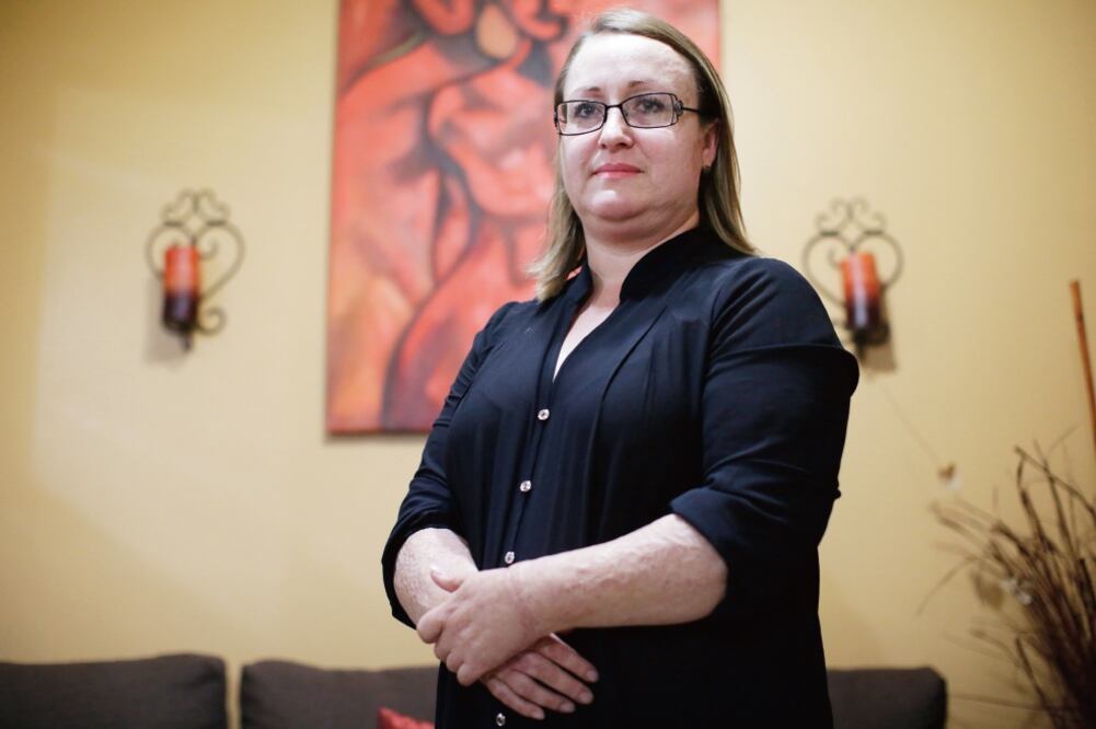 Diana James era la directora de la guardería ABC cuando ocurrió el incendio que conmocionó al país en 2009. Ella tenía apenas ocho meses en el cargo. A siete años de la tragedia, Diana ha enfrentado una batalla legal y cinco cirugías (LUIS CORTÉS)