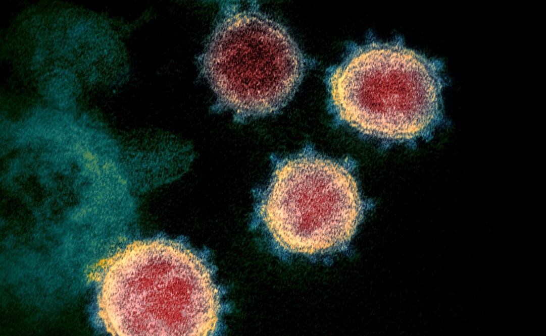 Foto: Handout / National Institutes of Health / AFP