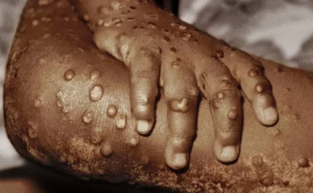 Foto: BBC/El Universal