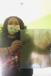 Estudiente que rifo un chivo en Tamaulipas, recibirá apoyo para su operación de riñones