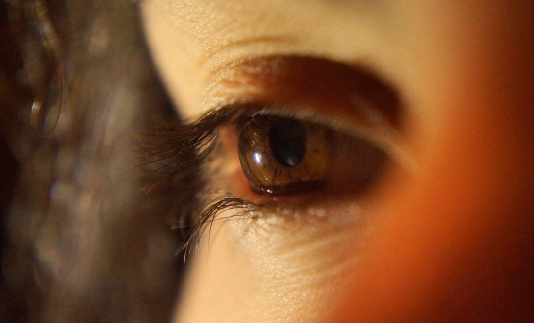 Glaucoma. Fuente: Pixabay