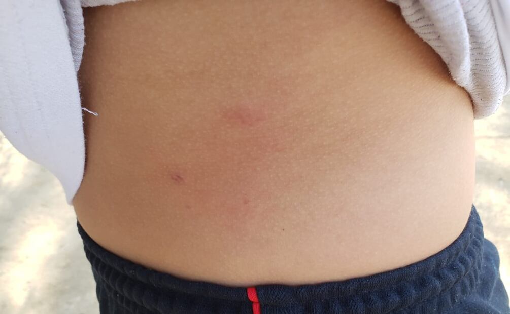 Niños de escuela primaria en Pátzcuaro, Michoacán, son atacados por un perro. Foto: Especial