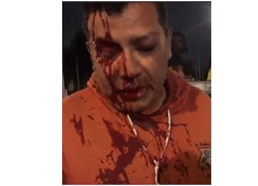 CDH condena agresiones a reporteros de TV Azteca y Reforma en la Doctores