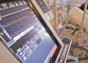 Officials are removed from the IMSS for their involvement in the purchase of overpriced ventilators from León Bartlett’s company