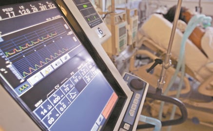 Officials are removed from the IMSS for their involvement in the purchase of overpriced ventilators from León Bartlett’s company