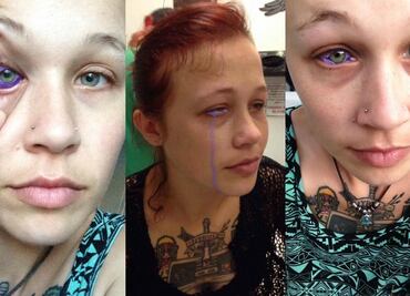 Tatuaje ocular deja parcialmente ciega a modelo canadiense