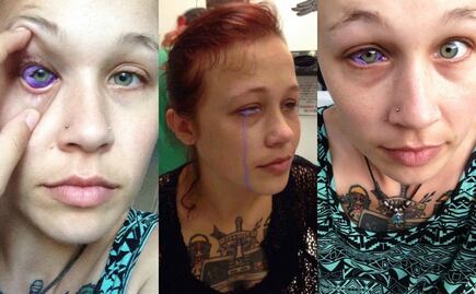 Tatuaje ocular deja parcialmente ciega a modelo canadiense 